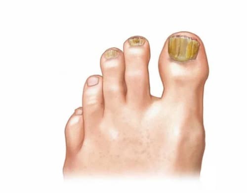 Foot Trooper comment utiliser